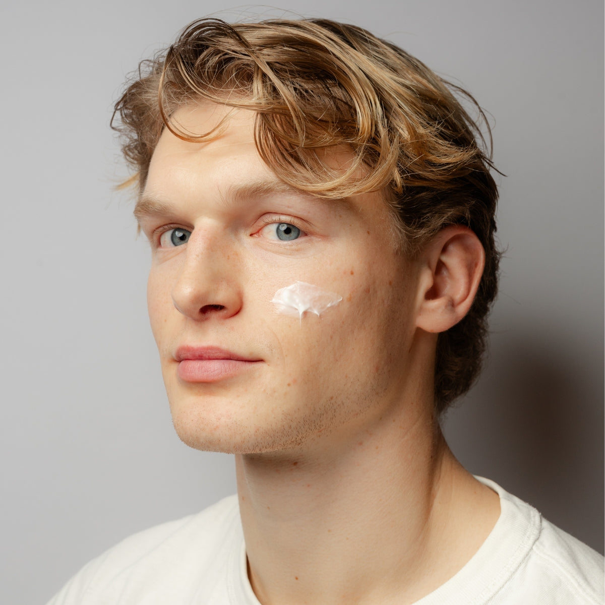 Acne-udsat hud